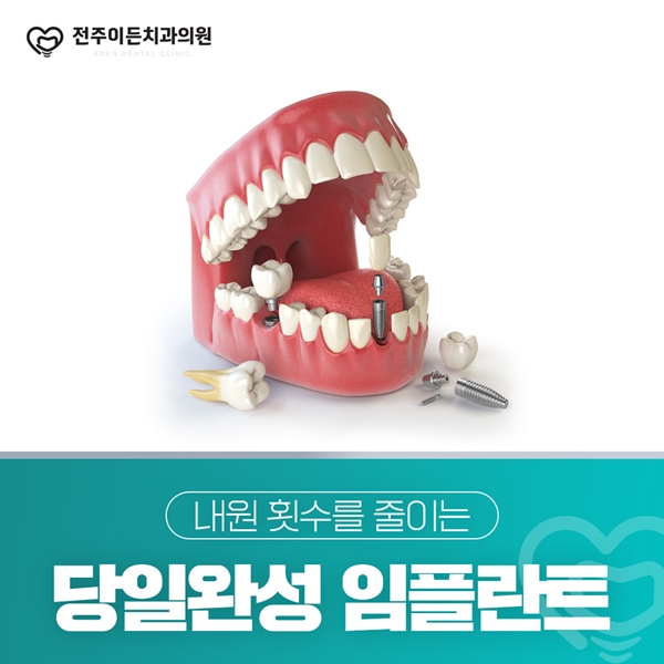당일완성 임플란트로 내원횟수를 줄여보세요